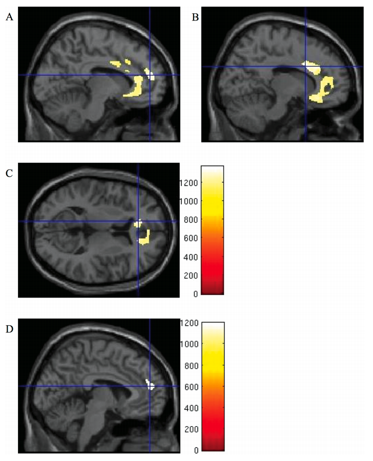 af085c7716b1457d161afb5bcee86b12_1622176732_2203.png af085c7716b1457d161afb5bcee86b12_1622176732_2203.png